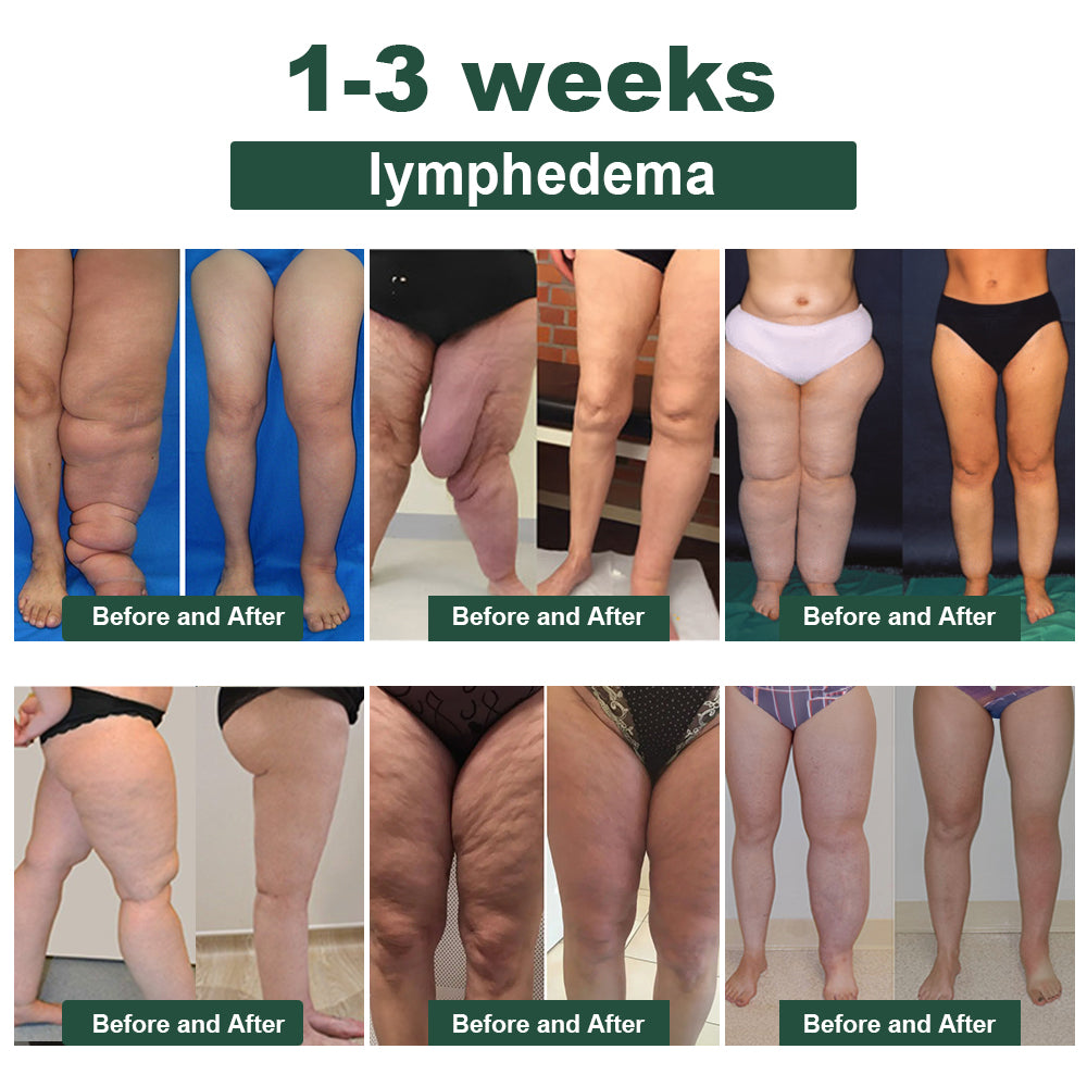 ๐๐๐ง๐๐ญ๐ฎ๐ซ๐โข ๐๐๐ ๐๐๐ง๐จ๐ฆ ๐๐ฅ๐ข๐ฆ๐ฆ๐ข๐ง๐  ๐๐ฒ๐ฆ๐ฉ๐ก๐๐ญ๐ข๐ ๐๐๐ญ๐จ๐ฑ ๐
๐จ๐จ๐ญ ๐๐จ๐๐ค ๐๐๐๐๐ฌ๐ซ- ๐๐๐ฒ๐จ ๐๐ฅ๐ข๐ง๐ข๐ ๐ฑ๐พ๐ผ๐๐๐๐พ๐๐ฝ๐พ๐ฝ(๐๐ซ๐ฎ๐ฌ๐ญ๐๐ ๐๐ฒ ๐จ๐ฏ๐๐ซ ๐ ๐ฆ๐ข๐ฅ๐ฅ๐ข๐จ๐ง ๐๐จ๐ง๐ฌ๐ฎ๐ฆ๐๐ซ๐ฌ ๐ฐ๐จ๐ซ๐ฅ๐๐ฐ๐ข๐๐)