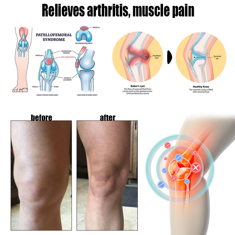 ๐๐๐ง๐๐ญ๐ฎ๐ซ๐โข ๐๐๐ ๐๐๐ง๐จ๐ฆ ๐๐ฅ๐ข๐ฆ๐ฆ๐ข๐ง๐  ๐๐ฒ๐ฆ๐ฉ๐ก๐๐ญ๐ข๐ ๐๐๐ญ๐จ๐ฑ ๐
๐จ๐จ๐ญ ๐๐จ๐๐ค ๐๐๐๐๐ฌ๐ซ- ๐๐๐ฒ๐จ ๐๐ฅ๐ข๐ง๐ข๐ ๐ฑ๐พ๐ผ๐๐๐๐พ๐๐ฝ๐พ๐ฝ(๐๐ซ๐ฎ๐ฌ๐ญ๐๐ ๐๐ฒ ๐จ๐ฏ๐๐ซ ๐ ๐ฆ๐ข๐ฅ๐ฅ๐ข๐จ๐ง ๐๐จ๐ง๐ฌ๐ฎ๐ฆ๐๐ซ๐ฌ ๐ฐ๐จ๐ซ๐ฅ๐๐ฐ๐ข๐๐)